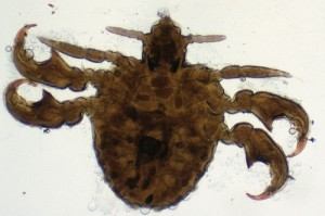 4. Pubic Lice (Crabs)