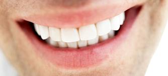 teeth whitening products