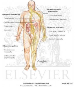 Diabetic Neuropathy